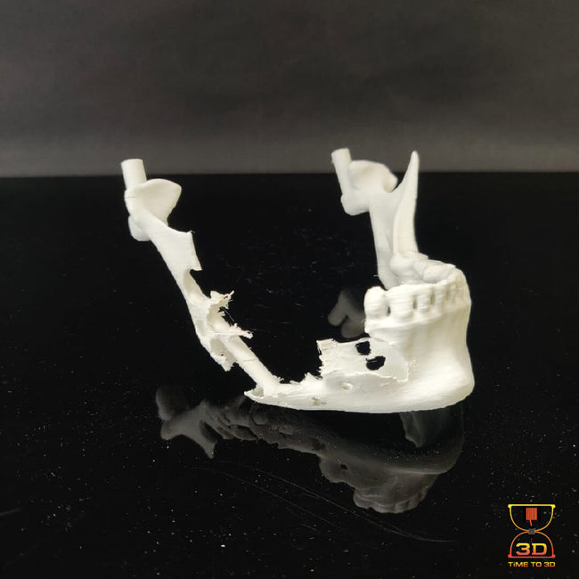 3D Printed model of a jaw